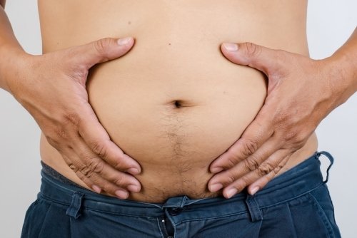 Abdominoplastia masculina