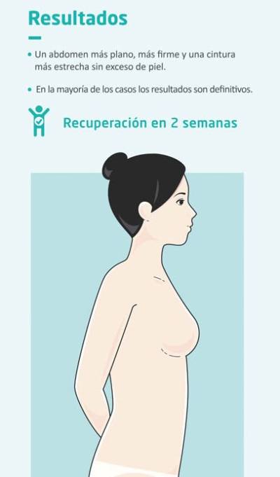 Resultados de la abdominoplastia