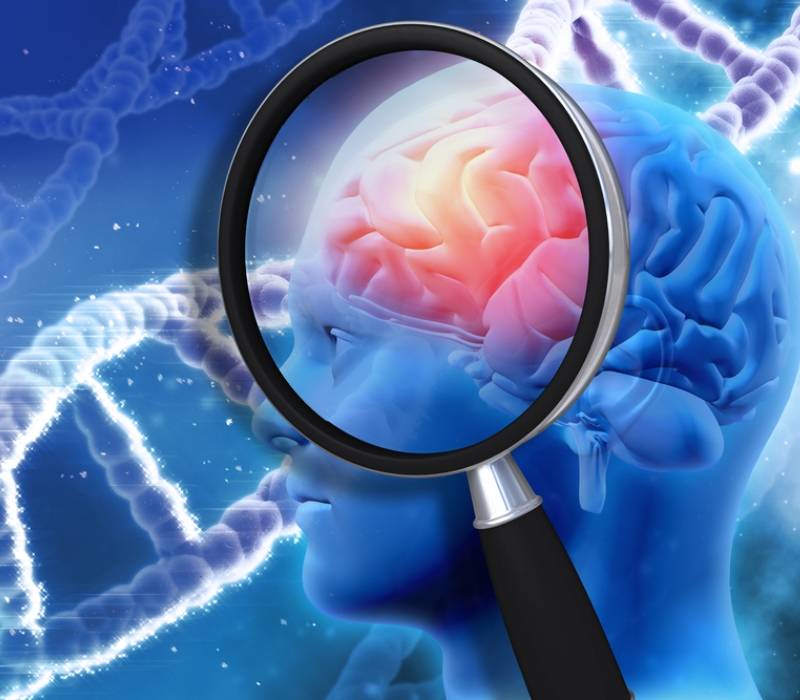 ¿Alzhéimer o hidrocefalia? La importancia del diagnóstico