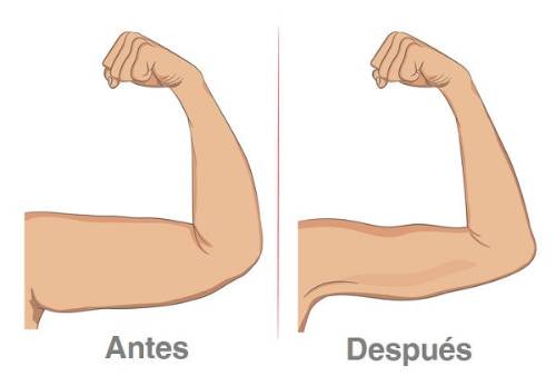 Antes y después del tratamiento estético