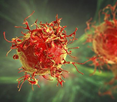 Células cancerosas de la piel