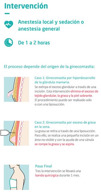 Cirugía de la ginecomastia o reducción de pecho en los hombres