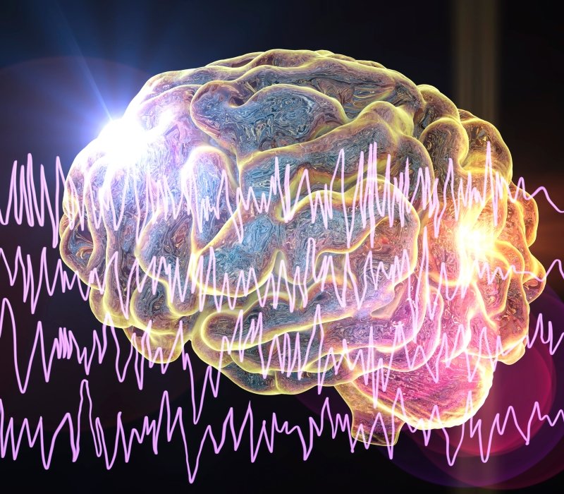 Concepto de epilepsia