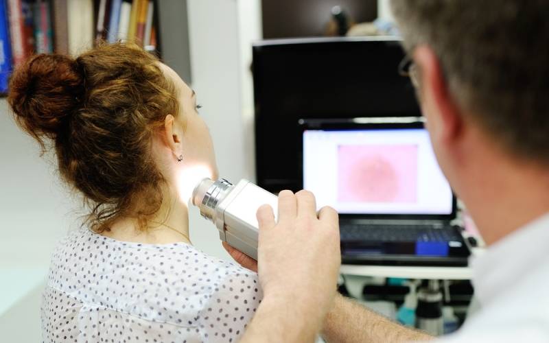 Dermatoscopia digital para la detección de melanoma