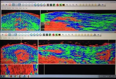 Detalles de las nuevas ecografías