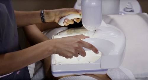 Ecografía automática de mama o ABUS