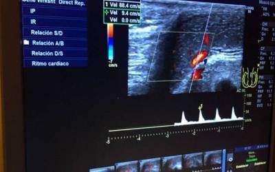 Mediciones en tiempo real de la ecografía Doppler