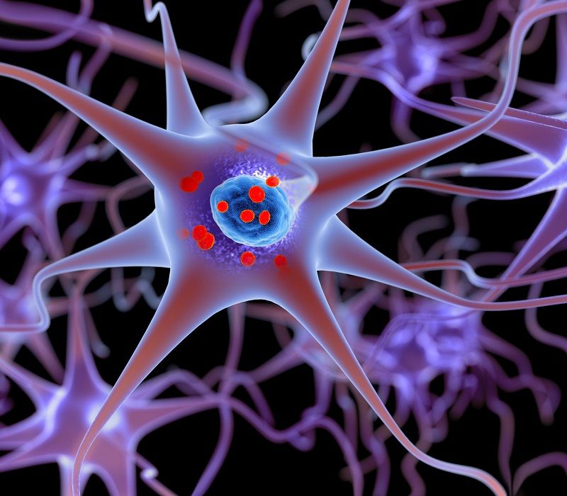 Parkinson: síntomas, causas y tratamientos