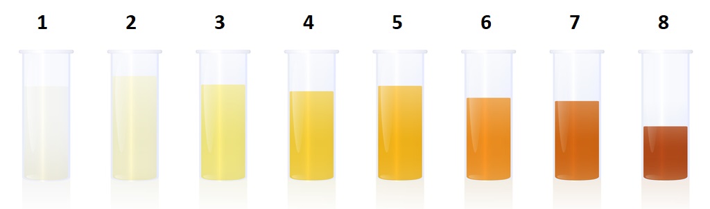 Escala de colores de orina