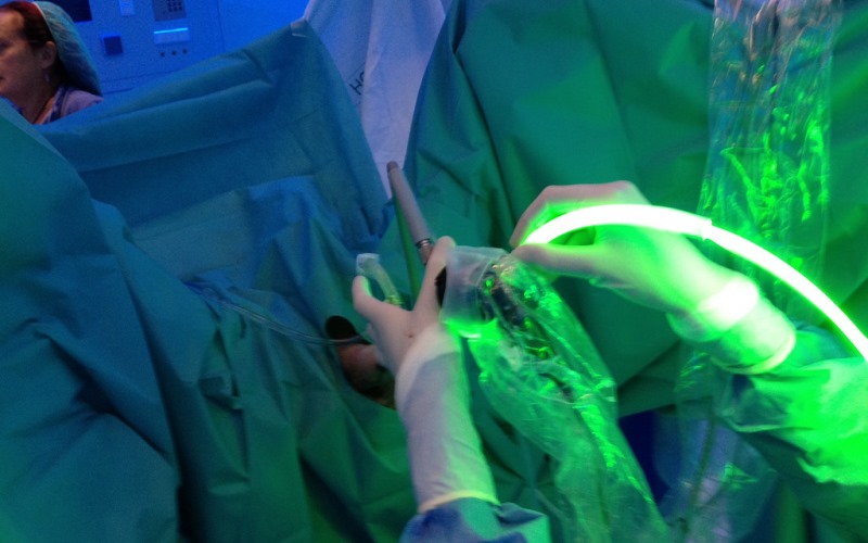 Láser en cirugía de próstata