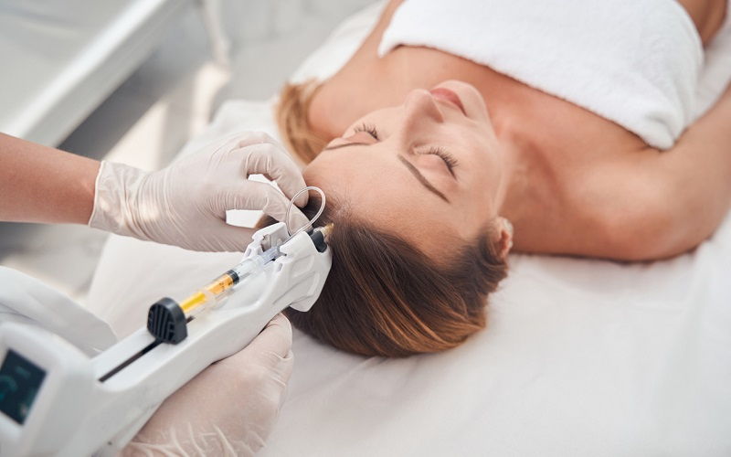 Mesoterapia capilar con pistola para frenar la caída de cabello