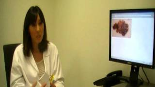 Melanoma: prevención y detección
