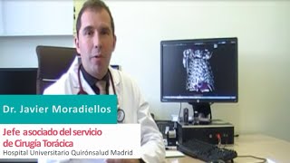 Prótesis impresas en 3D en cirugía torácica