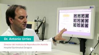 Sistema EEVA, el test mas objetivo para la selección de embriones en Reproducción Asistida