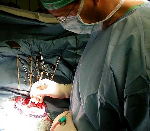 Neurocirugia con paciente con despierto