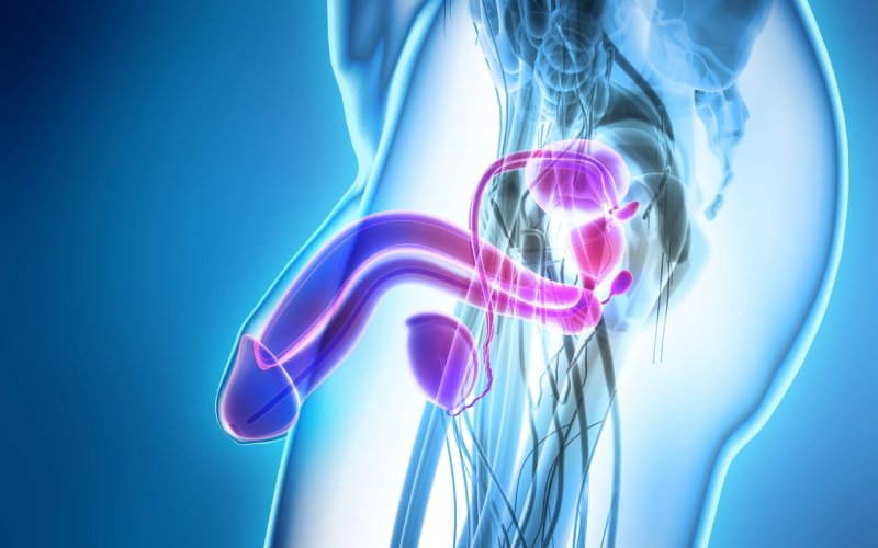 Ondas de choque para la disfunción eréctil
