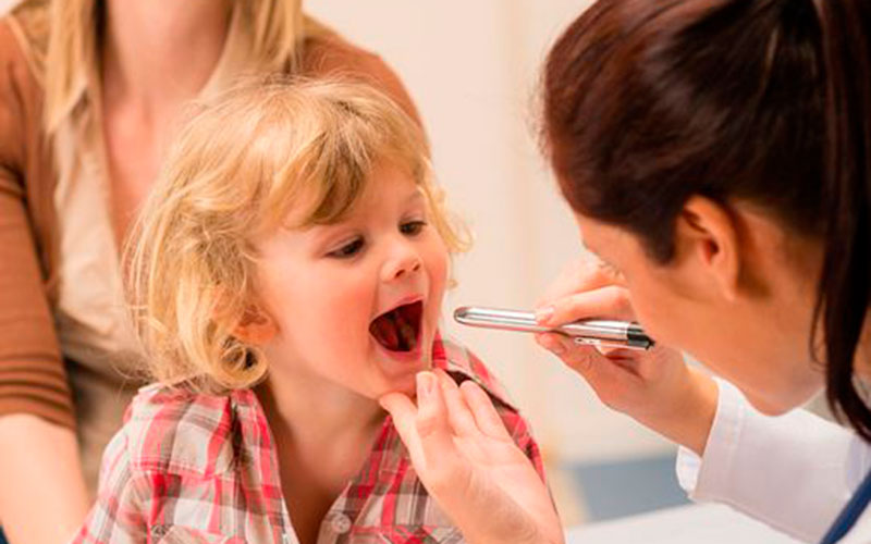 ¿Qué son las amígdalas y cuándo se operan?