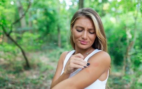 ¿Eres alérgico a las picaduras de mosquito? Síntomas y causas