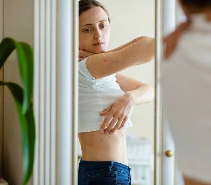 10 preguntas y respuestas sobre la psoriasis