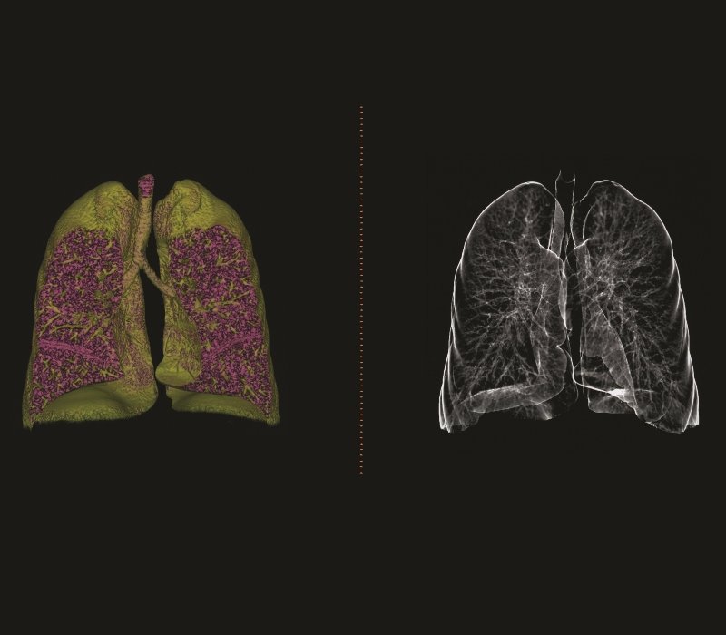 Imagen de tomografía computarizada