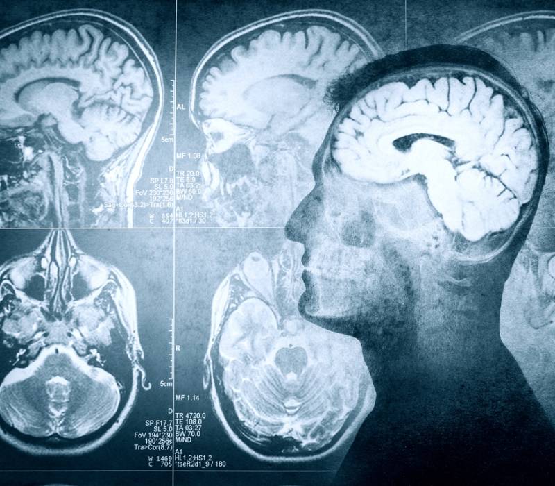 Relación entre fibrilación auricular