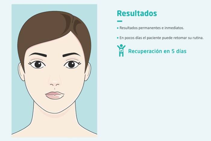 Resultados de la otoplastia
