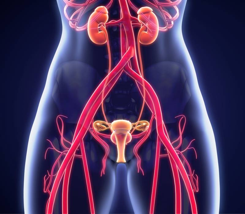 ¿Sabes qué es el síndrome de congestión pélvica?