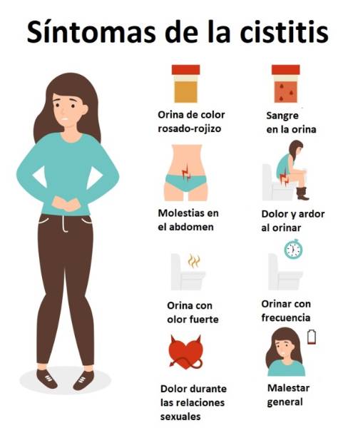 Síntomas de la cistitis