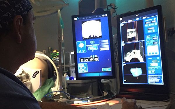 Terapia focal y sus ventajas en el cáncer de próstata