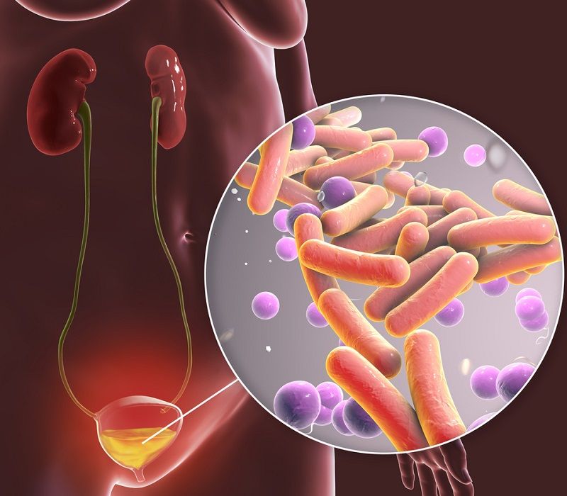 Vacuna para prevenir las infecciones de orina