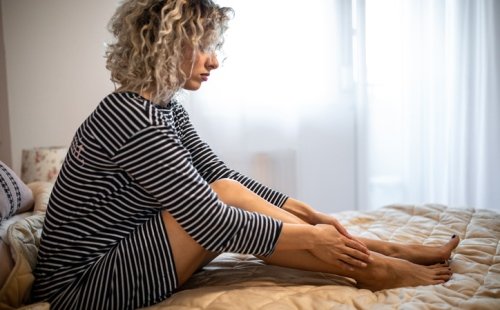 Varices: más allá de la estética